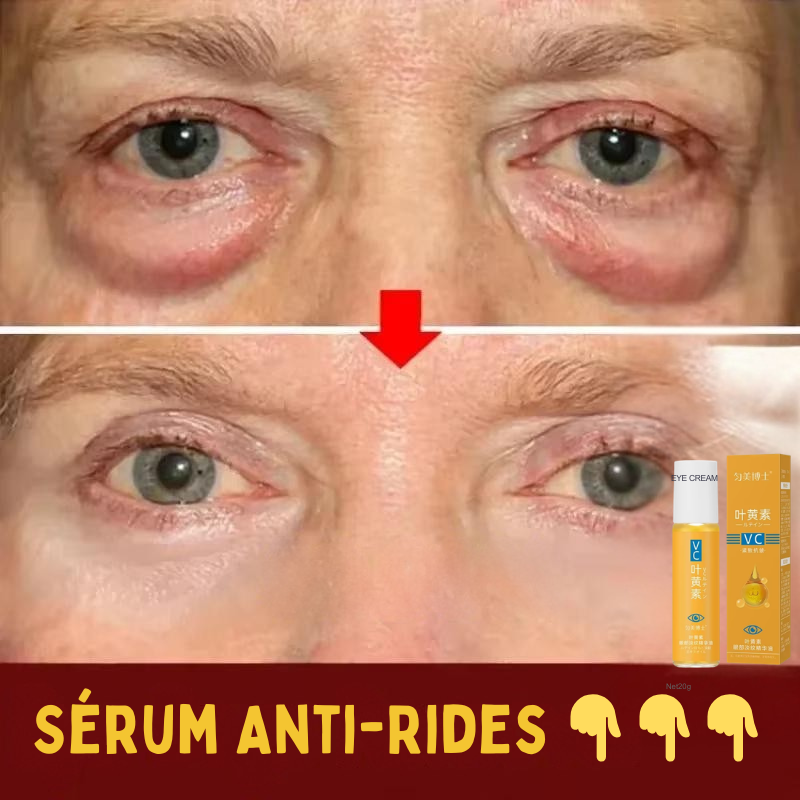 Sérum Anti-Rides Contour des Yeux Propre (1 ACHETÉ = 1 OFFERT ! 🎁) SN
