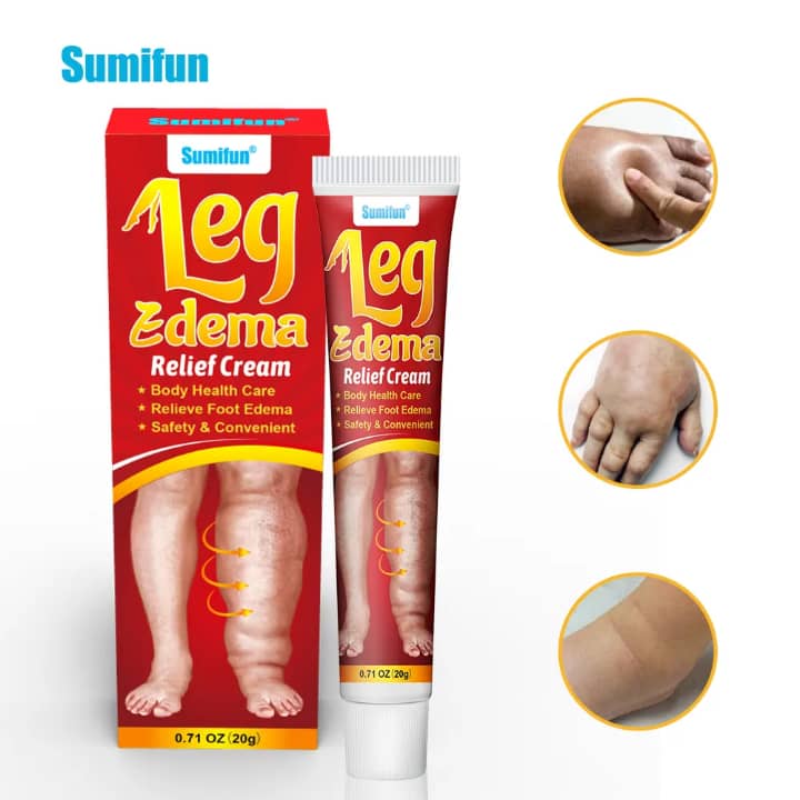 Crème  Anti-Gonflement — Jambes Légères en 7 Jours ou Remboursé