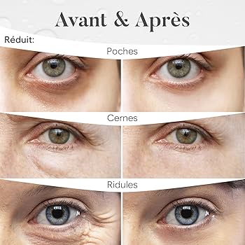 Sérum Anti-Rides Contour des Yeux Propre (1 ACHETÉ = 1 OFFERT ! 🎁)